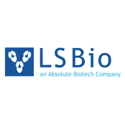 Human ACRV1/Intra-Acrosomal Protein (Recombinant 6His, C-terminus) (Gln22-Ile265) - LS-G38931